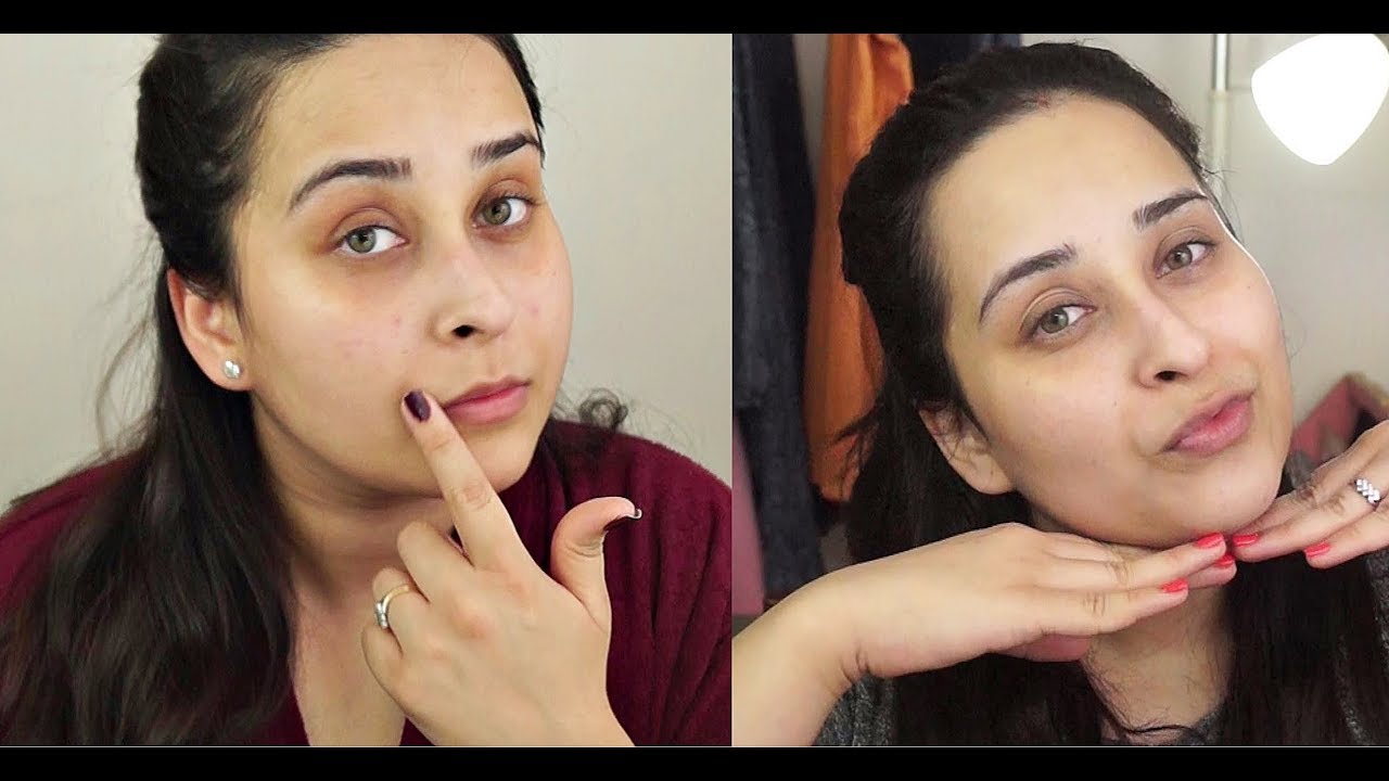 OZONE Acne Healing Treatment Kit Demo and Review YouTube