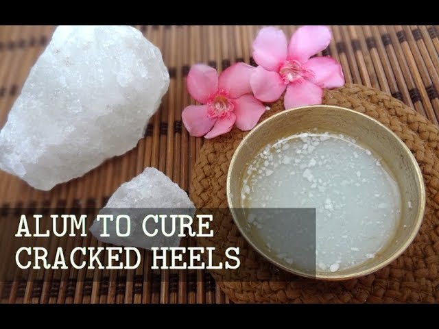 Amazing Uses of Alum | Cracked Heels - Wrinkles - YouTube