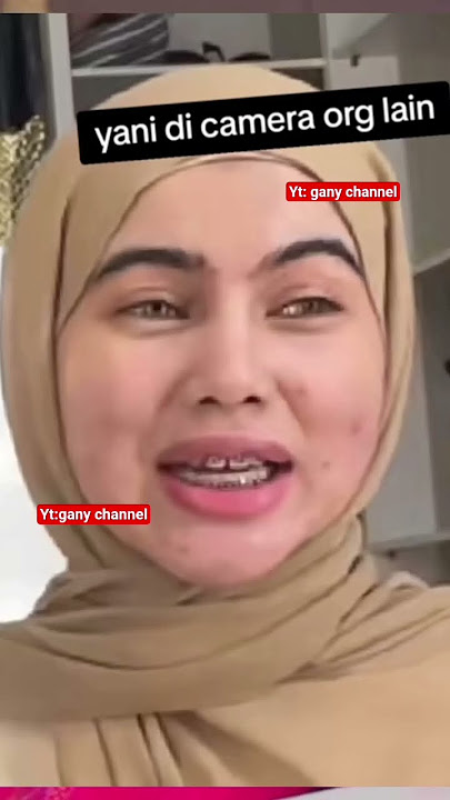 salfok gigi elvy yg afa gang nya🤭 #akashellahi #vennyalberti #elvyabdullah #fyp #viral #trending