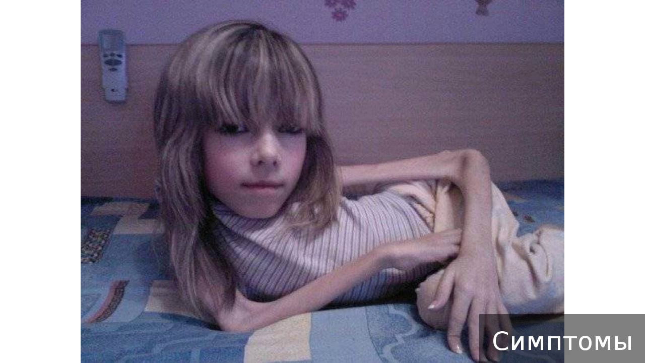 Амиотрофия. Как лечить амиотрофию.