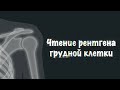 Чтение рентгена грудной клетки