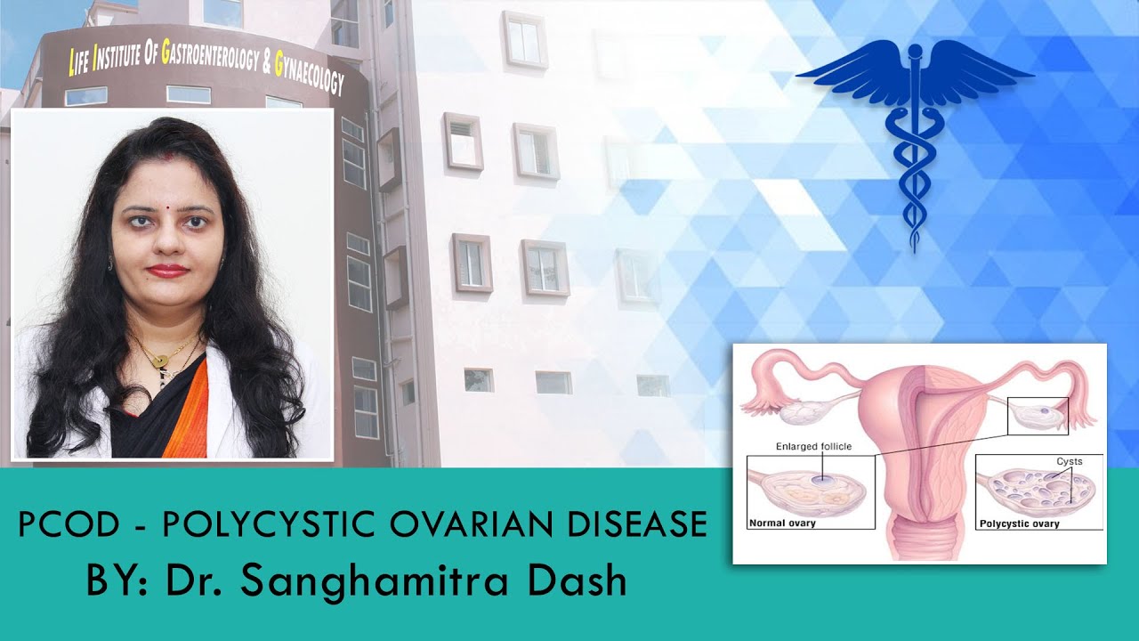PCOD - POLYCYSTIC OVARIAN DISEASE || Dr Sanghamitra Dash || LIGG Hospital