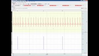 Noldus Observer XT Import/Export in AcqKnowledge 4.3