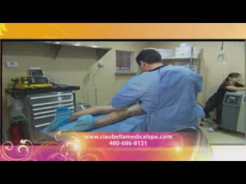 Liposuction at Ciao Bella Medical Spa on Better AZ