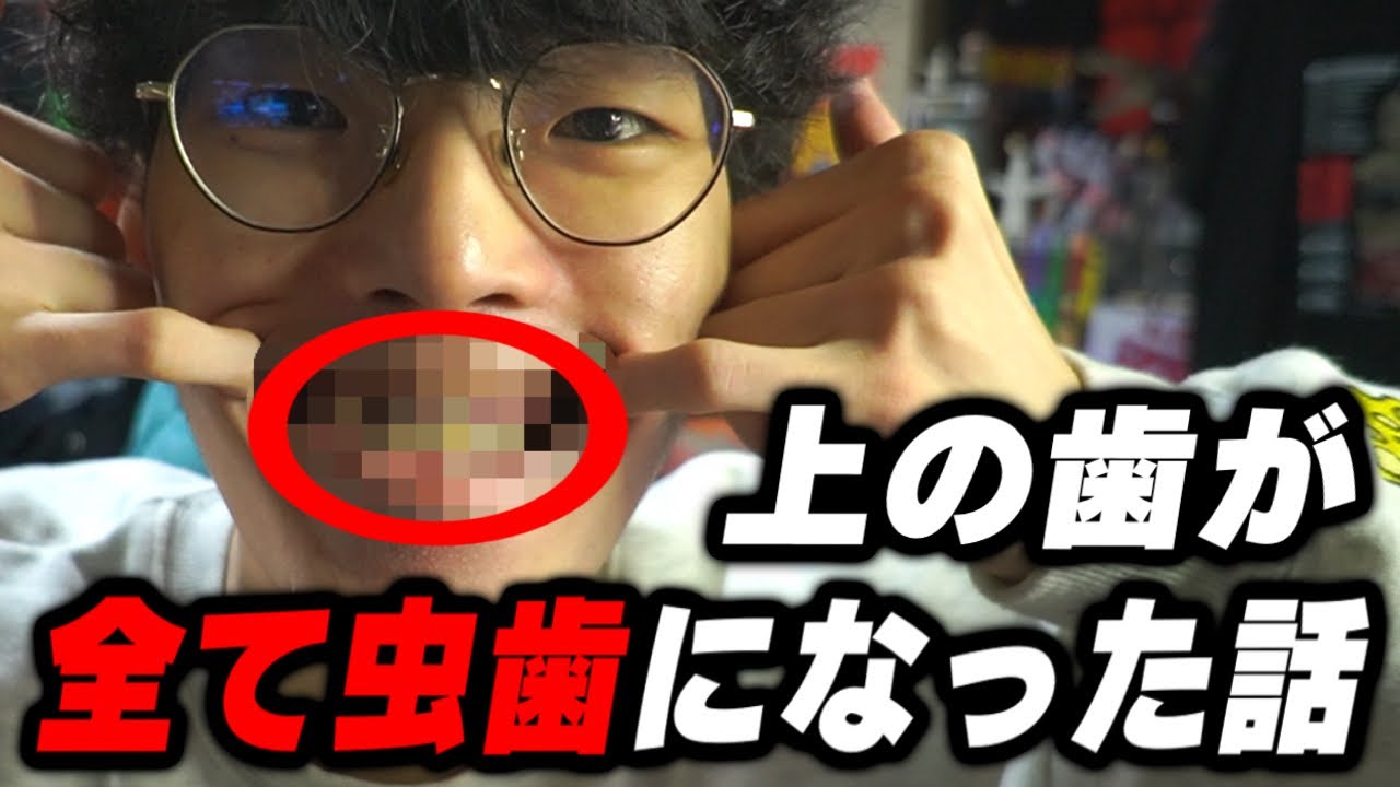 上の歯が全て虫歯になった話