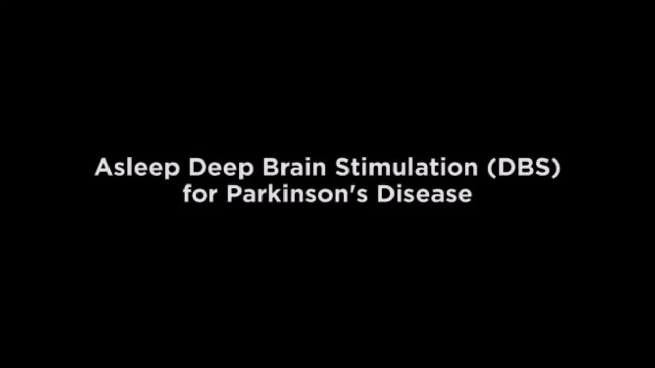 Asleep Deep Brain Stimulation DBS for Parkinson's Disease Edited