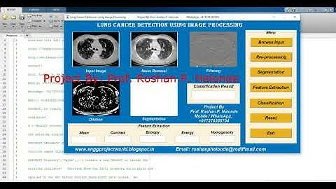 Lung Cancer Identification Using Image Processing Matlab Project With Source Code Lung Cancer Detect