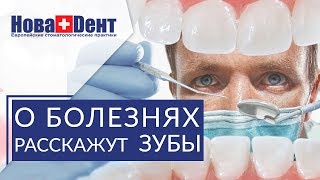 👅 О каких заболеваниях можно судить по языку и запаху изо рта. Диагностика заболеваний по языку. 12+