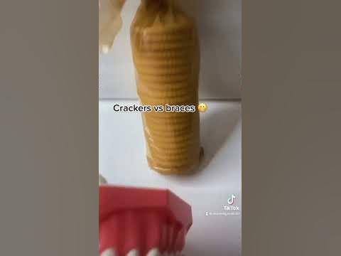 Crackers vs braces #crackers #tiktok #braces #dentist #teeth - YouTube