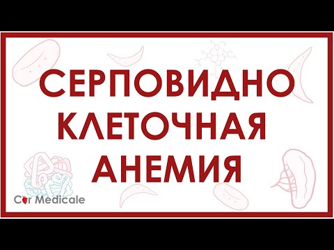 Серповидноклеточная анемия: что такое, механизм развития, симптомы, принцип лечения