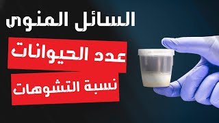 مشاكل الحيوانات المنوية .. انخفاض الاعداد ونسية التشوهات و علاقتها بحدوث الحمل ناجح