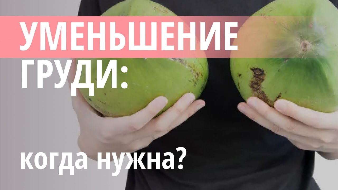 📌 Редукционная маммопластика: когда показана? - YouTube