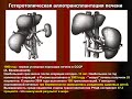 Лекция 2 (ЛФ-1) - Трансплантация органов и тканей