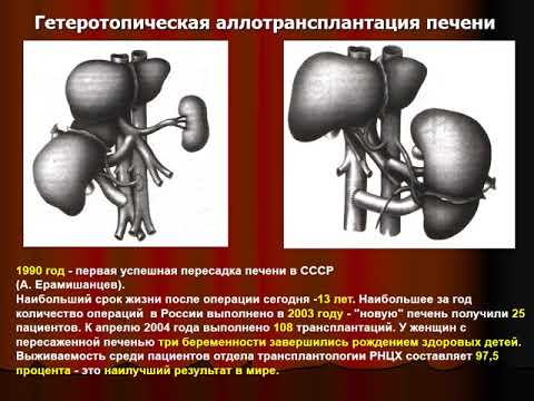 Лекция 2 (ЛФ-1) - Трансплантация органов и тканей