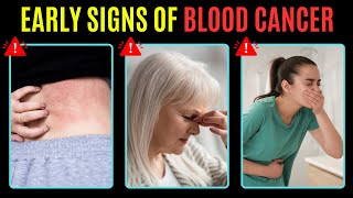 Early signs of Blood Cancer (Doctors Never Say These Symptoms Of Blood Cancer)