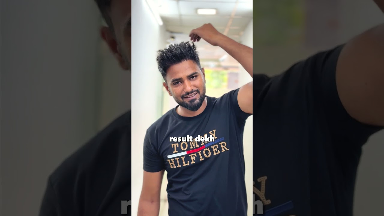 Hair Transplant Technology: What's New in 2025