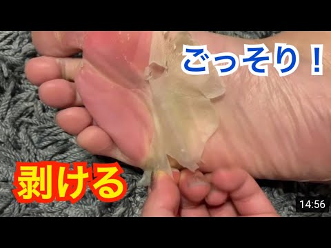 ベビーフット 足の裏の皮を剥いてみた 見るasmr 脱皮 足パック Exfoliation It Feels Good Movie Youtube