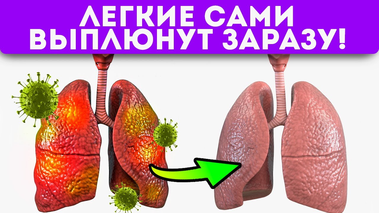 Сейчас должен знать каждый! Лечение пневмонии и коронавируса по методу ...