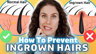 How To Get Rid Of Ingrown Hairs  Advice From A Medical Esthetician