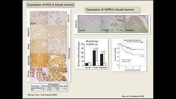 Sima Lev: Epithelial–Mesenchymal Transition: EMT