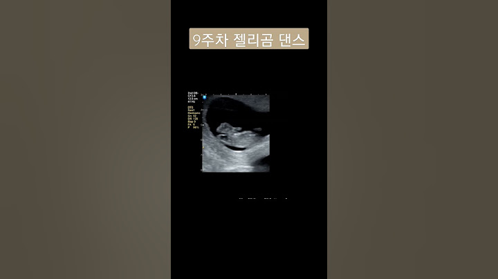 임신 초음파 9주차 젤리곰 쪼쪼댄스(셔니의 과거) #dancing  #growthscan
