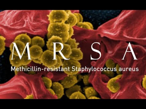 Penyakit MRSA ( Methicillin-Resistant Staphylococcus Aureus )