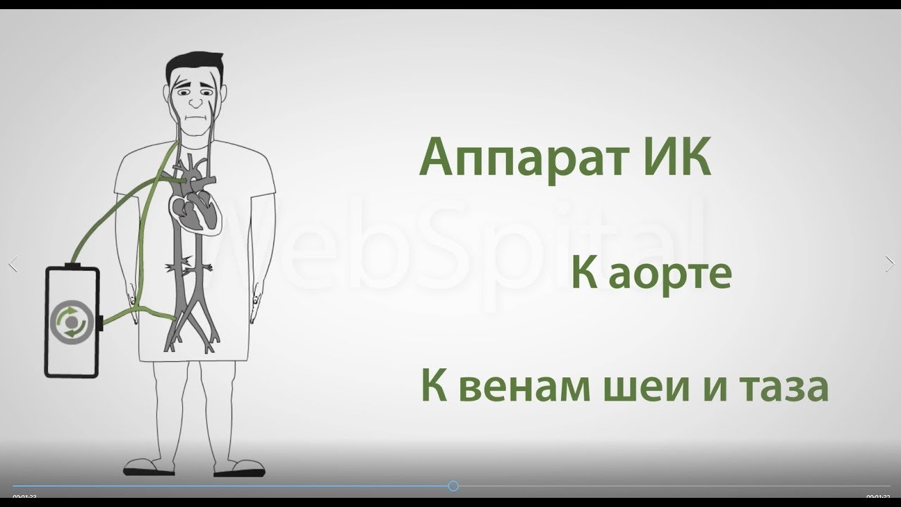 Пластика трикуспидального клапана