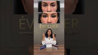 Mastering the Art of Facial Rejuvenation: The Magic of Fillers! Wealth