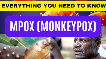 What is MPOX (Monkeypox)? |  Monkeypox Outbreak 2024