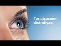 Макулодистрофия сетчатки глаза  -  Офтальмолог Эльмира Юсубова