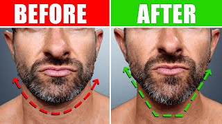 How to FIX a Soft Face & Weak Jawline (ASAP)