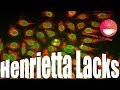 Henrietta Lacks - nieśmiertelna kobieta (?)