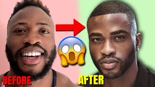 5 Ways To INSTANTLY Improve Your Looks | How To Become More Attractive FAST!!