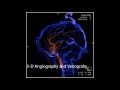 3-D ROTATIONAL CEREBRAL ANGIOGRAPHY