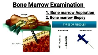 Bone Marrow Examination || Bone marrow Aspiration || Bone marrow biopsy  in hindi