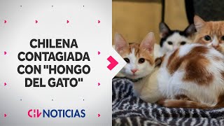 PRIMER CASO de chilena contagiada con el 'Hongo del Gato': ¿Cuáles son los síntomas?  CHV Noticias