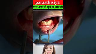 parasthisiya ( अब ये क्या हो गया) #shorts #shortfeed