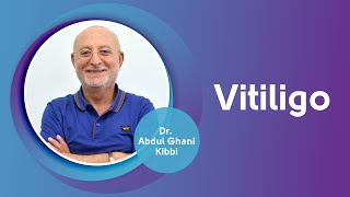 مرض البهاق، اسبابه وطرق علاجه مع الدكتور عبد الغني كبّي | Vitiligo, causes and treatments