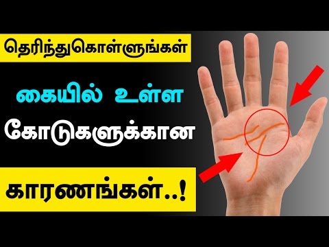 Reasons for Lines in Our Hand Palms - Why do We Have Lines in Palms? (Know the Facts) hqdefault