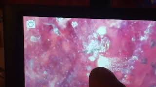 Ruby's Carrie asteroids as well