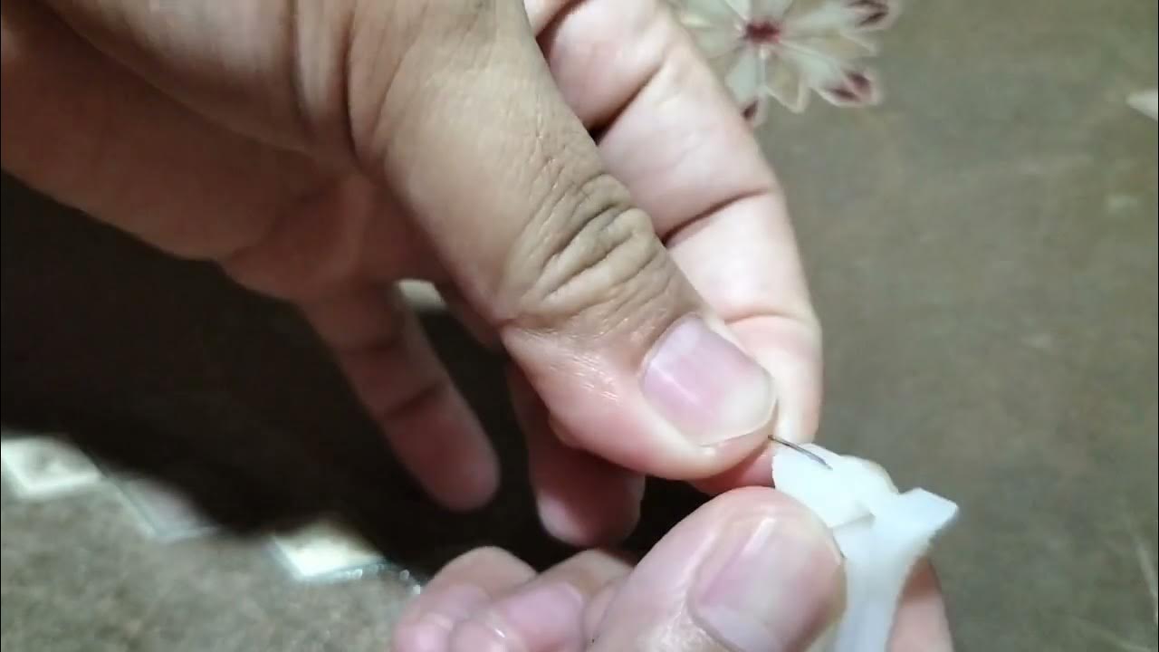 How to unclamp umbilical cord clamp YouTube