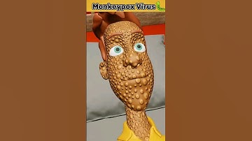 Monkeypox Virus | How Monkeypoxvirus KILLS?(3D Animation) #shorts #youtubeshorts