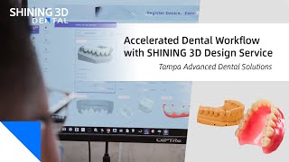 Accelerated Dental Workflow🦷 with SHINING 3D Dental Design Services💎