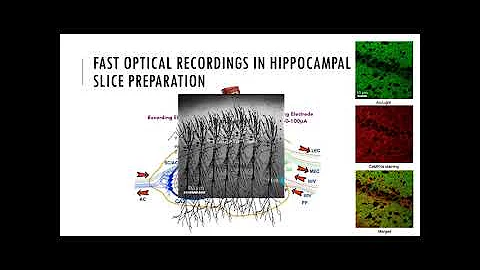 4th HSfN vitual seminar - Dr. Efstratios Kosmidis