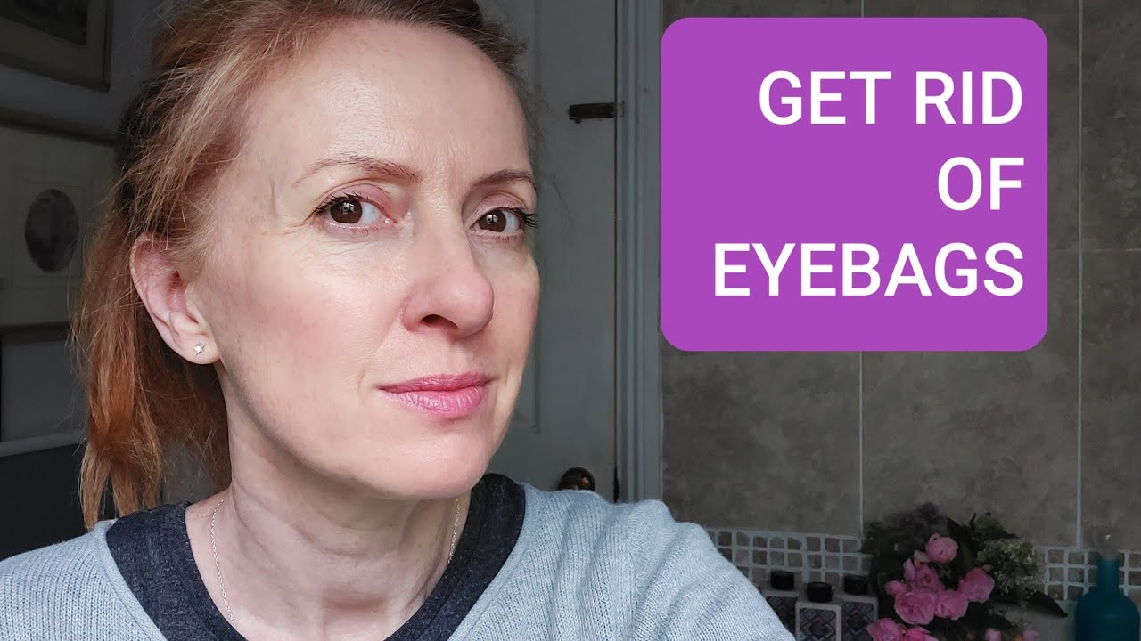 HOW TO GET RID OF BAGS UNDER THE EYES YouTube