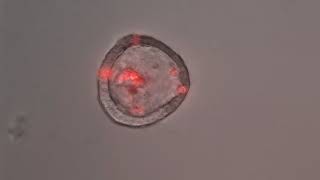 Enteroid treated with FlaTox, Propidium Iodide
