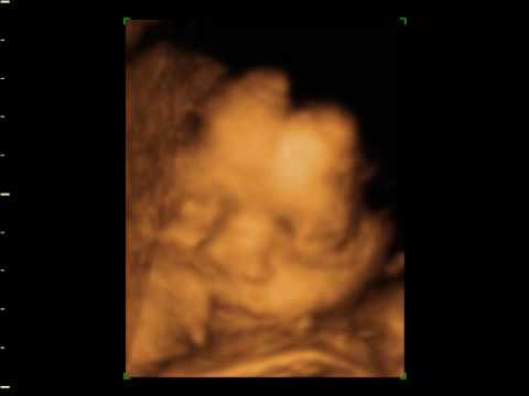 annalisa minetti Baby of Annalisa and Mark