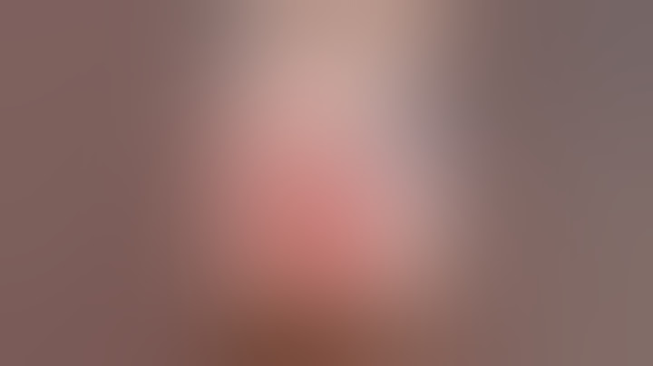 Quem já viu um dente do siso a ser removido? 🦷😱