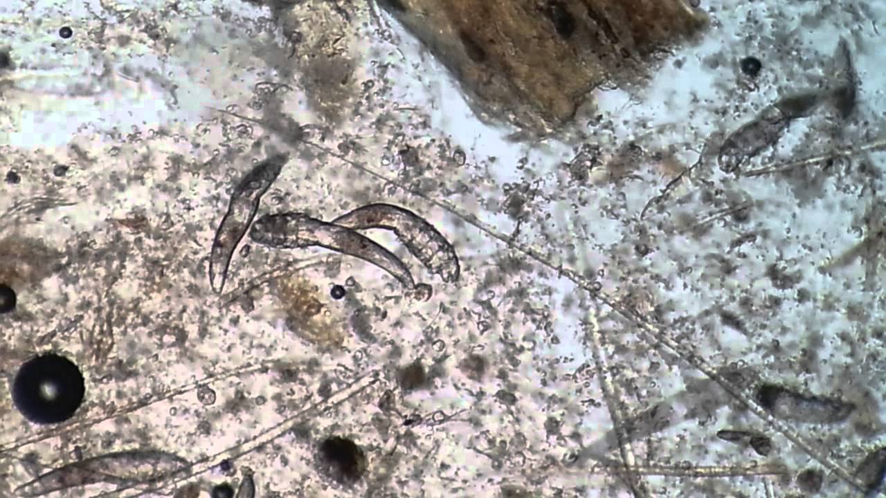 Demodex canis from a Canine patient - YouTube