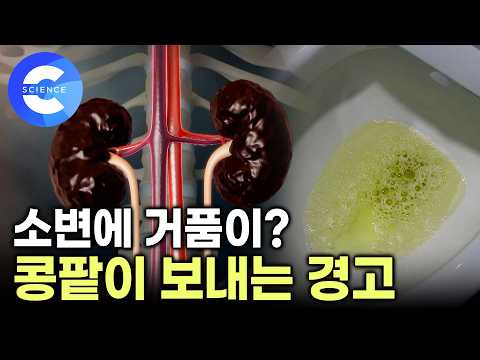 몸이 붓고 피곤하다면? 콩팥병 신호 | 소변에 거품이 생기면 이미 콩팥병 진행 중 | 콩팥병 예방하는 식습관 | 귀하신 몸